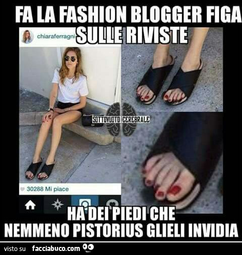 Fa la fashion blogger figa sulle riviste, ha dei piedi che nemmeno Pistorius glieli invidia