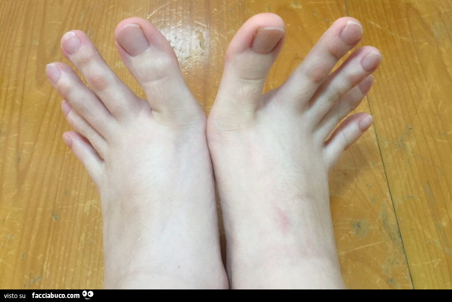 Strani piedi