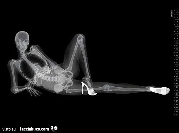 Radiografia coi tacchi